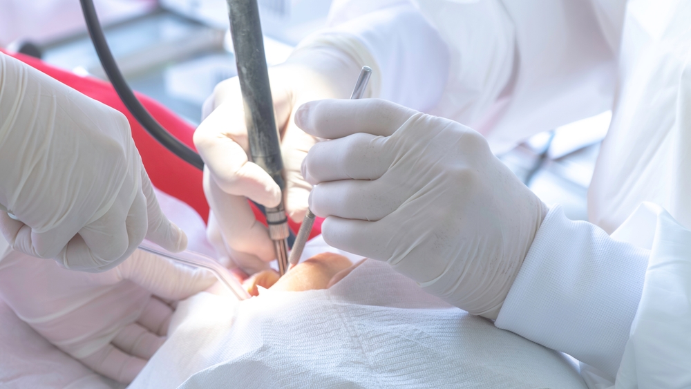 Zabieg leczenia kanałowego