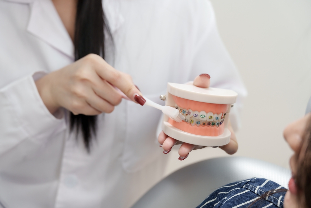 Higiena jamy ustnej w aparacie – najczęstsze błędy i jak ich uniknąć?